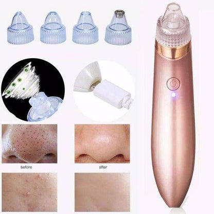 Electric blackhead remover